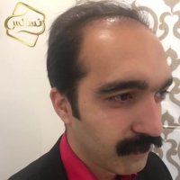 کاشت مو رنسانس - کلینیک تخصصی رنسانس
