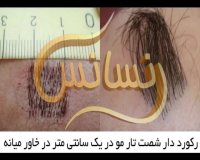 کلینیک کاشت مو رنسانس