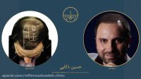 حسین ذکایی قبل و بعد از کاشت مو در کلینیک دکتر نیلفروش زاده