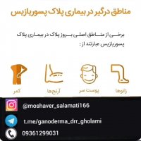 روش های درمان بیماری زگیل تناسلی