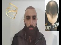 نظرات مراجعین مرکز تخصصی مو رنسانس