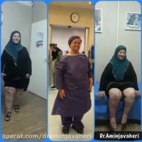 فحص المریضه قبل و بعد استبدال مفصل الحوض