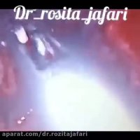 نقص قاعده جمجمه