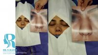 جراحی زیبایی بینی مراجعه‌ کننده عزیز