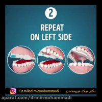 فیلم طرز صحیح مسواک زدن