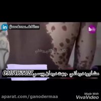 تقويت سيستم ايمني بدن و بازگشت و توليد رنگدانه هاي پوستي بااين دارو.09154165027