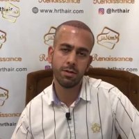 کاشت مو | کلینیک تخصصی رنسانس  02122088210