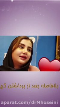 داستان جراحی بینی در 8 روز