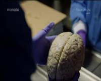 دانلود مستند زوال عقل چیست ؟