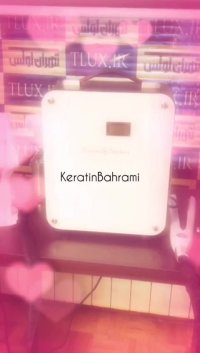 آیرون فروزن