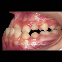 ارتودنتیست تهران | دکتر داودیان