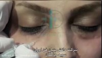 فیلم آموزشی جوانسازی  و از بین بردن تیرگی اطراف چشم با کربوکسی تراپی