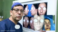 جراحی بینی به همراه لیفت لب