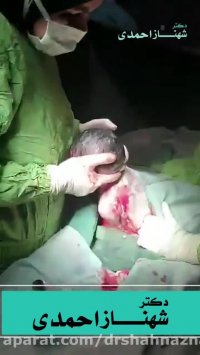 زایمان سزارین دکتر شهناز احمدی