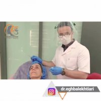 تزریق پروفایلو جهت آبرسانی و جوانسازی صورت