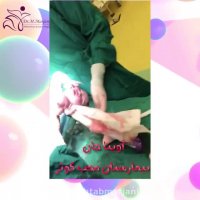 فیلم زایمان سزارین