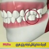 روش صحیح میواک زدن