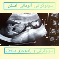 فیلم انومالی اسکن همراه با توضیحات خانم دکتر