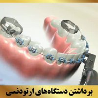 دکتر ارتودنسی | دکتر داوودیان