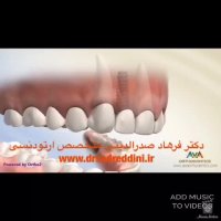 متخصص ارتودنسی در غرب تهران