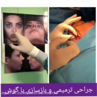 بهترین جراح بینی ترمیمی در تهران
