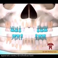 اهمیت حفظ و نگهداری از دندان های شیری در کودکان