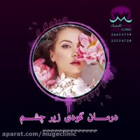 درمان گودی زیر چشم