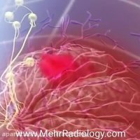 ماموگرافی سینه