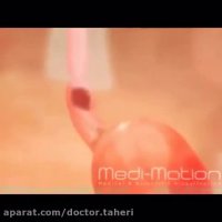 عملکرد کلی دستگاه گوارش