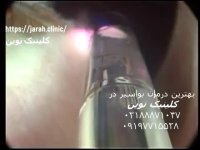 جدیدترین و بهترین راه درمان بواسیر در کلینیک نوین https://jarah.clinic/