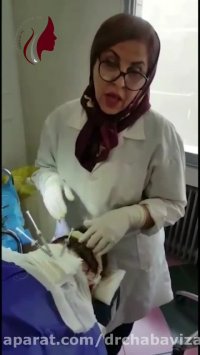 کاشت موی سر خانم ها- دکترچعباوی زاده