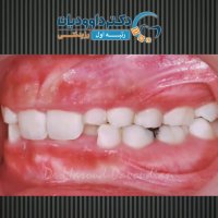 ارتودنسی غرب تهران | دکتر داوودیان