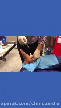 درمان مفصل مچ پا با آرتوكين تراپى