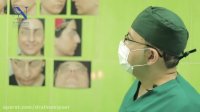عمل زیبایی بینی در کرج