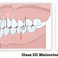 دکتر داودیان | متخصص ارتودنسی