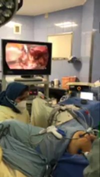 بخشی از وبینار جراحی کیست اندومتریوز برای متخصصین توسط دکتر مهدوی