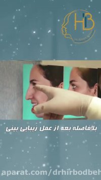 فیلم جراحی بینی