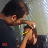 وقتی موهای عطاران یهویی میریزه