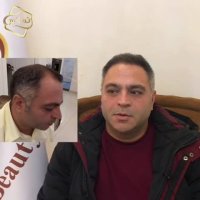 کاشت مو به روشSUT -کلینیک تخصصی رنسانس