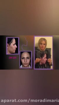 جراحی زیبایی بینی