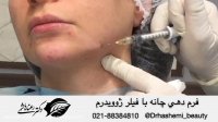 فرم دهی به چانه با تزریق فیلر ژوویدرم