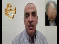 نظرات مراجعین مرکز تخصصی مو رنسانس