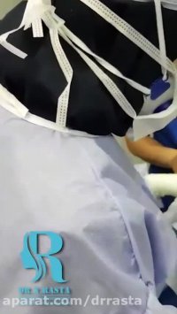 جراحی بینی در نژاد آسیایی و افغان