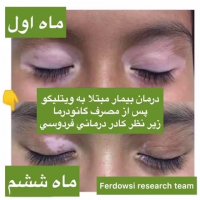 پیسی درمانی دارد؟