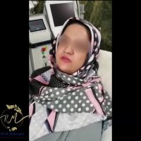 فیلم درمان لک صورت