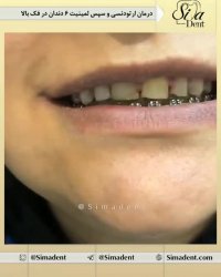 کلینیک دندان در تهران | سیمادنت