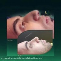 نمونه کار جراحی بینی در لرستان