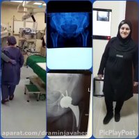 معاینه بیمار بعد از تعویض مفصل لگن ناشی از سیاه شدن سر استخوان ران