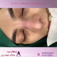 فیلم عمل زیبایی بینی