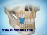 مراحل رشد دندان